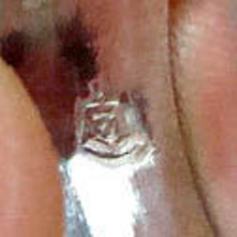Taxco Mexico Sterling Silver Ring Azur-malachite Stone